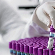 zece clinici vor derula programul gratuit de fertilizare in vitro si embriotransfer al ministerului sanatatii