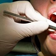 marea britanie peste 22 de mii de oameni ar putea fi infectati cu hepatita sau hiv din cauza unui singur dentist