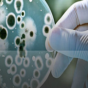 coronavirusul circula prin incaperi si sisteme de aerisire si poate infecta peste 200 de experti au transmis un avertisment catre oms