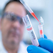 institutul de sanatate publica a actualizat definitiile de caz pentru sindromul respirator acut cu noul coronavirus si recomandarile de prioritizare a testarii pentru covid-19