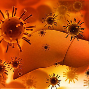hepatita c boala care ucide in liniste simptomele apar abia in fazele foarte avansate