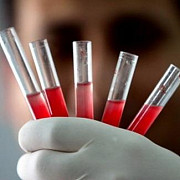 institutul national de hematologie colecta de sange a scazut la nivel national cu o treime este pragul critic facem apel la donare