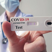 testarea rapida in farmacii pentru depistarea covid-19 aprobata de ministerul sanatatii