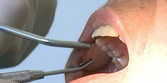 de ce servicii gratuite poti beneficia in acest an la dentist