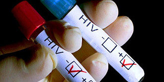 istoria genetica a hiv sida a aparut pentru prima data in congo in 20 cum s-a ajuns la 75 de milioane de infectii